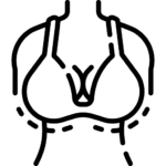 ব্রেস্ট